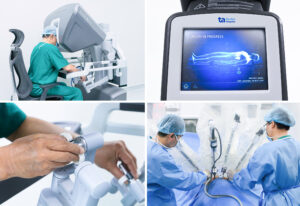 Hình ảnh 3D phóng đại trên hệ thống robot phẫu thuật Da Vinci Xi